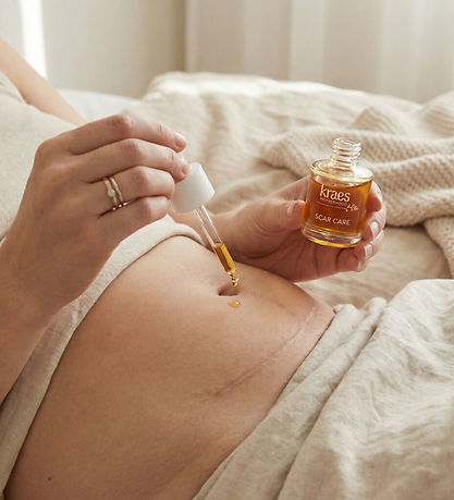 Kraes Scar Care - Motherhood - 20 ml