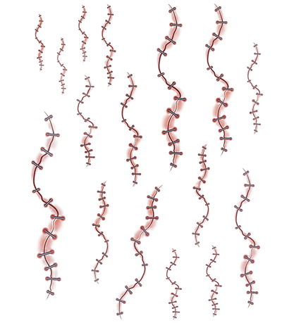 Smiffys Tatoveringer - Stapled Skin